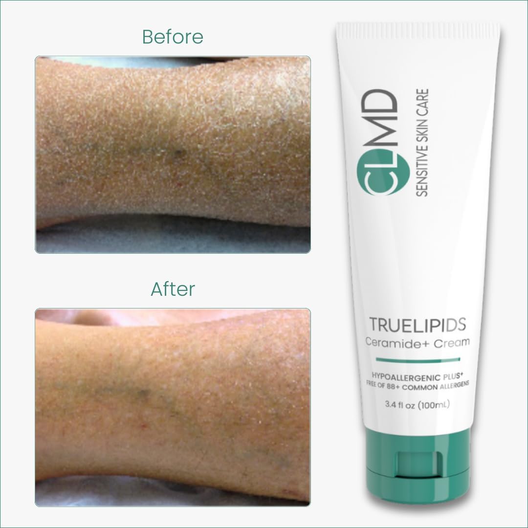 CLMD TrueLipids Ceramide+ Cream – Deep Moisturizing Barrier Support for Sensitive Skin – Hydrates and Soothes – Hypoallergenic, Nourishing, and Dermatologist-Tested – 3.4 fl oz-GlimoraGlow