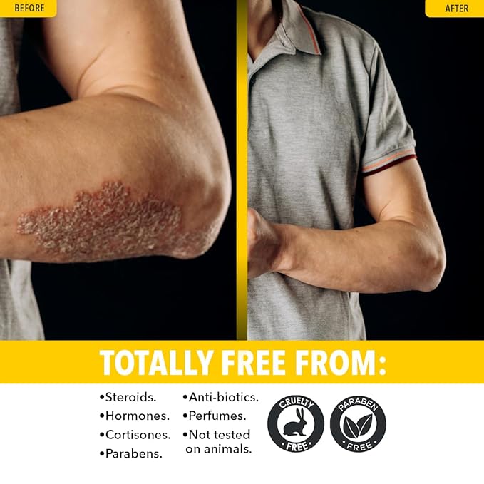 Dr. Robaina Sulfur Balsam Lotion – Lightweight Moisturizer for Dry, Flaky & Itchy Skin – Calms Redness, Supports Skin Barrier & Locks Hydration – Shea Butter & Tea Tree – 8 fl oz, USA Made-GlimoraGlow