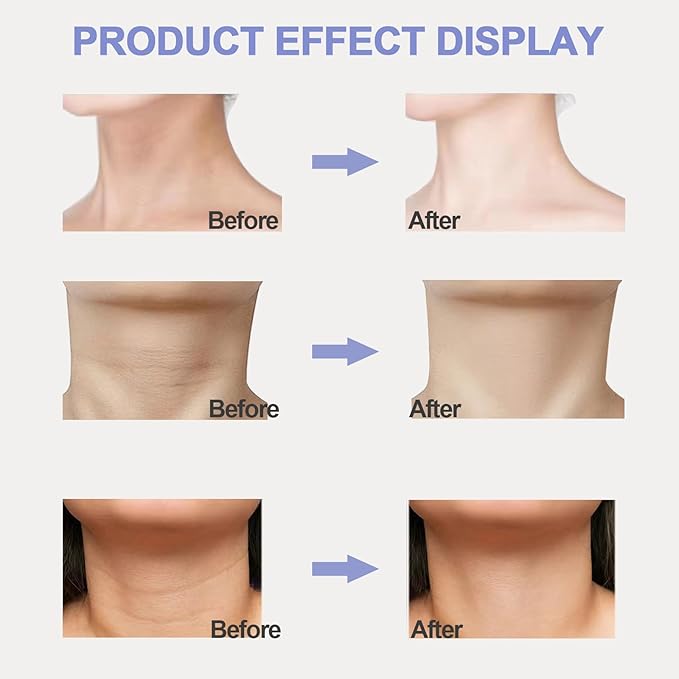 Neck Firming Cream, Neck Tightening Cream, Tighten and Lift Neck Cream, Neck Creams for Tightening and Firming Sagging Skin, Help Reduce Fine Lines & Wrinkles-GlimoraGlow