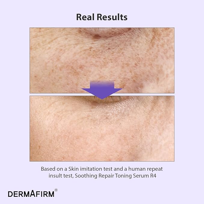 DERMAFIRM Bakuchiol Retinol Serum for Glass Skin with Niacinamide & Peptides | Daily Korean Skin Care for Sensitive Skin | Soothing Repair Toning Serum R4 for Glass Skin-GlimoraGlow
