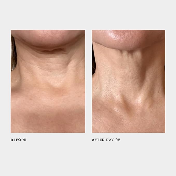 U Beauty The SCULPT Neck + Décolleté Concentrate-GlimoraGlow