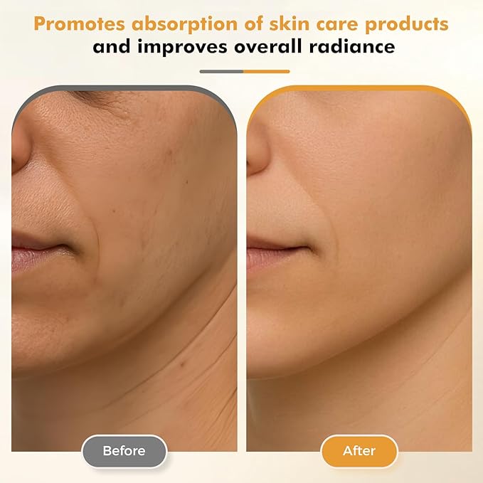 REDLOOK Depuffing Wand - Multi-Mode Cold & Heat Eye with Massager,At Home Face Roller Tool, Beauty Wand for Puffiness Reduction, Dark Circles, and Let The Skin Be Full of Radiance - Silver-GlimoraGlow