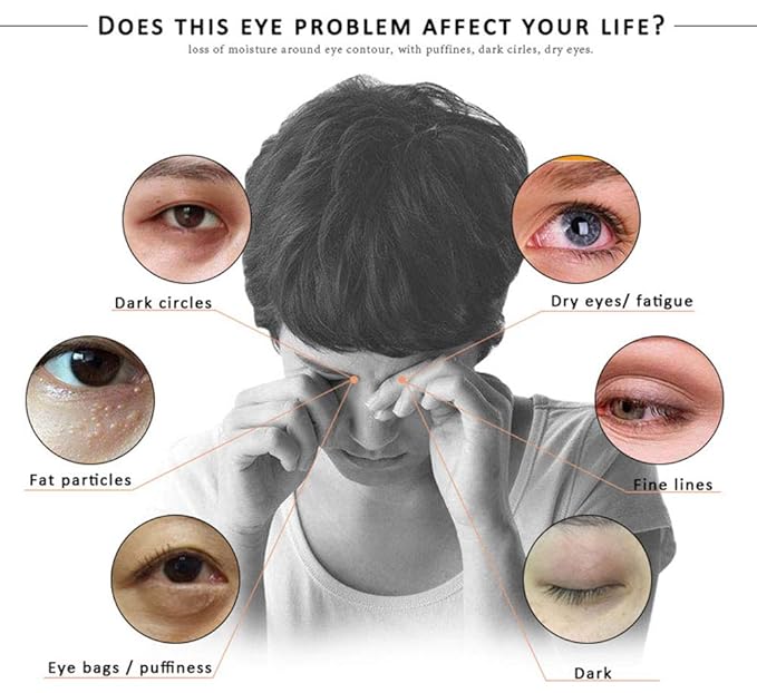 Eye Peptide Serum Eye Massage Roller Nourishing Relieve Loose Eye Bags Dark Circles Eye Skin Care Under Eye Cream for Fine Wrinkles and Puffiness Daily Skincare(Nourishing Grey)-GlimoraGlow