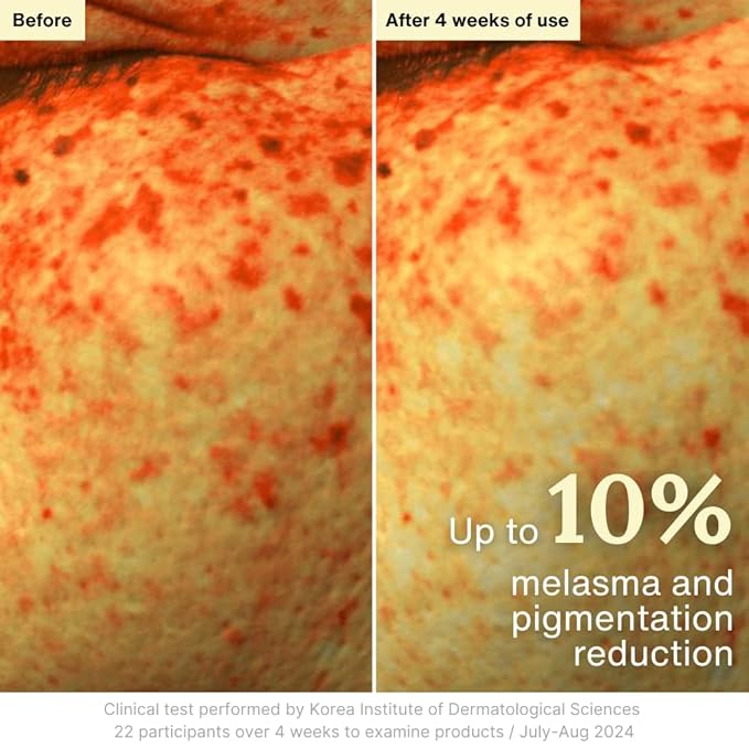 Rothea Resilience Cream, Anti-Aging with Bakuchiol 10,000ppm (Natural Retinol Alternative), Face Moisturizer, Neck Cream with Collagen, Ceramides, Peptides, Niacinamide, Korean Skin Care, 1.7 oz-GlimoraGlow