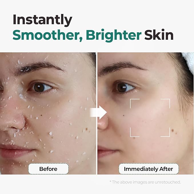 MOTHER MADE LHA Green Tea Exfoliating Aqua Peel Gel, Deep Pore Face Exfoliant, Gentle Facial Exfoliator, Dead Skin Remover, Natural Cellulose for Peeling, Vegan, Korean Skincare (100ml / 3.38 fl.oz)-GlimoraGlow