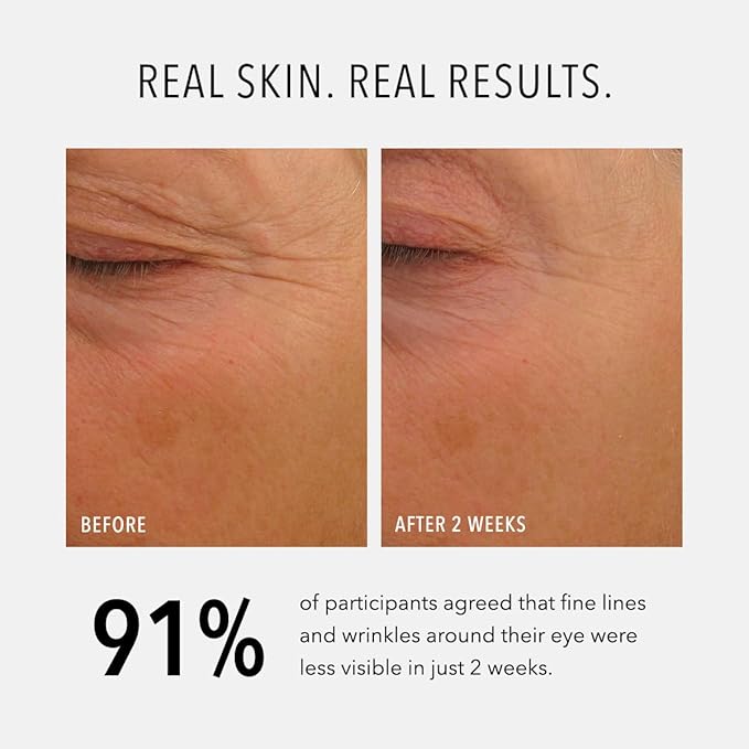 HydroPeptide Eye Authority, Brightens and Helps Restore Radiance to Tired Looking Eyes, 0.5 Ounce-GlimoraGlow