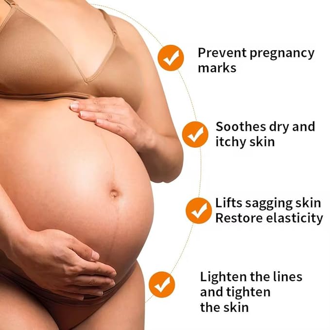 Stretch Mark Pregnancy Oil, Natural Oil Skincare Body Oil Serum for Scars and Stretch Marks, Face with Vitamin E & A for Sensitive Dry Skin and Body Moisturizer-GlimoraGlow