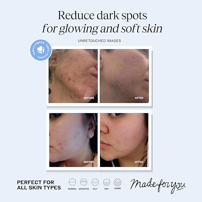 LilyAna Naturals Vitamin C Serum for Face with Hyaluronic Acid and Vitamin E, Anti Aging Serum, Reduces Age Spots and Sun Damage, Promotes Collagen and Elastin (1oz)-GlimoraGlow