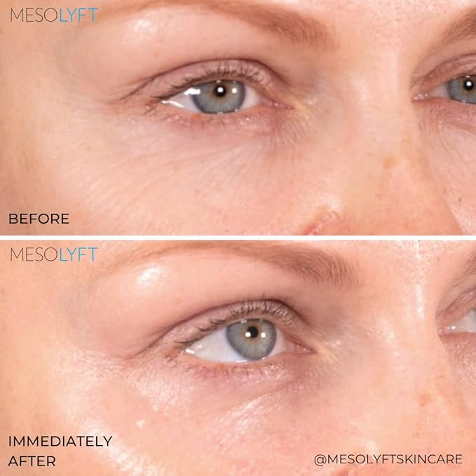 Neck & Eyes Combo Skincare Tool under Eye Serum With Neck Line Remover Neck and Décolletage Beuty Tool & Under Eye Wrinkle Filler Exfoliates the Skin, Visibly Firm & Smooth Necklines-GlimoraGlow