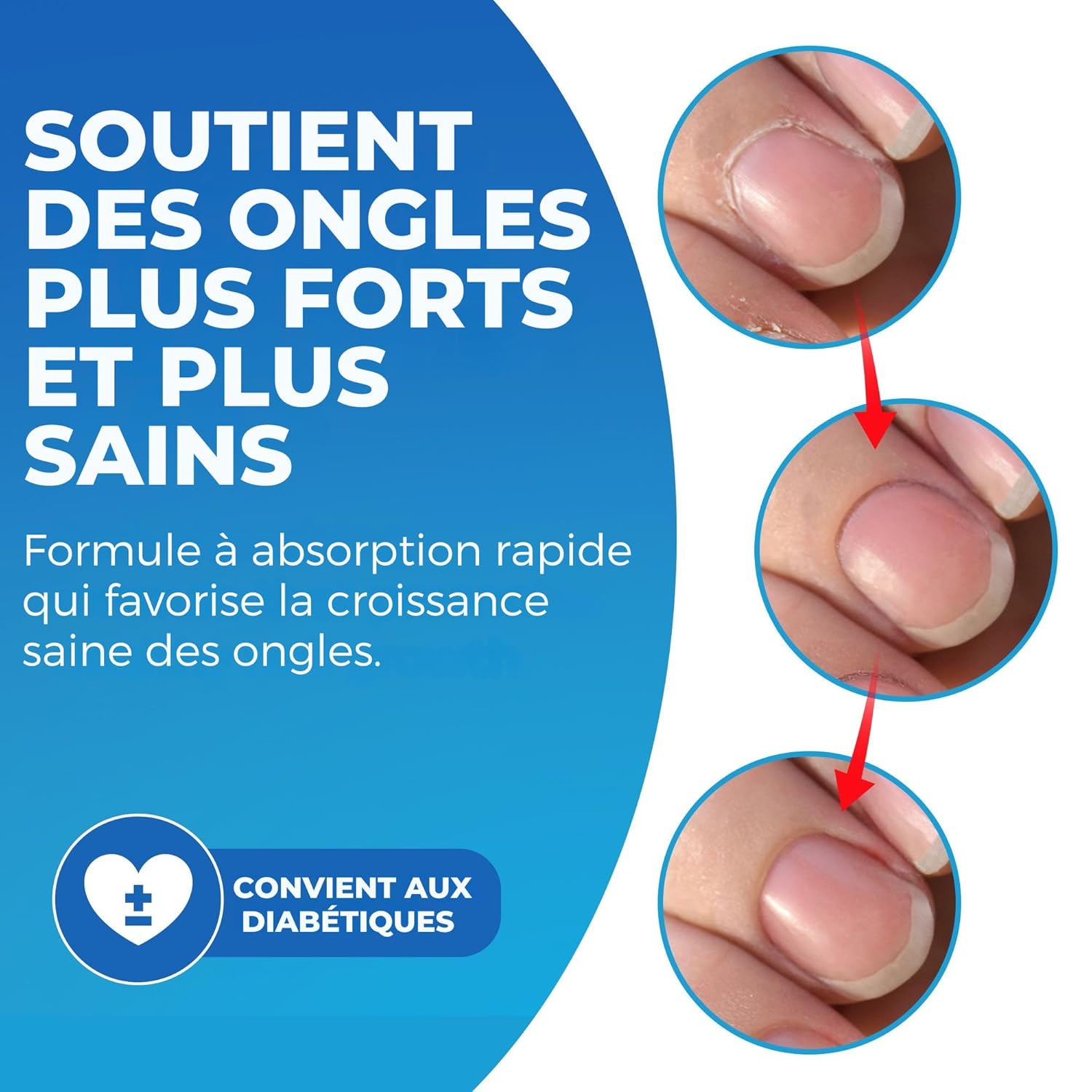 Imperial Feet Cuticle Oil for Nail Growth and Strength 30ml/1 FL Oz-Almond, Jojoba, Vitamin E Oil for Nails and Cuticles-Hydrates, Natural Nail Strengthener and Nourishes Dry Cuticles-Cuticle Softener-GlimoraGlow