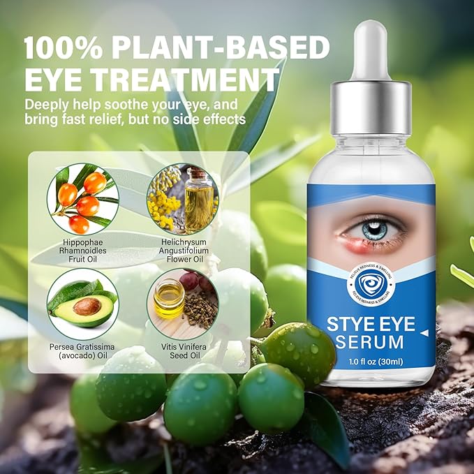 Stye Eye Treatment, Stye Eye Serum for Styes Chalazion and Blepharitis, Gently Cleanses Lashes and Eyes, Restore Healthier Eye Skin, 1 Fl.oz-GlimoraGlow