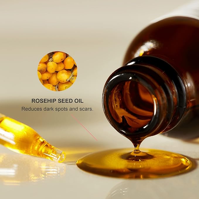 100% PURE Organic Rosehip Oil Moisturizer For Face, Body, Hair Hydrating Vitamins & Omega Fatty Acids Support Glowing, Plumped Up Youthful Skin - Natural Cold-Pressed Facial Radiance - Vegan - 1oz-GlimoraGlow