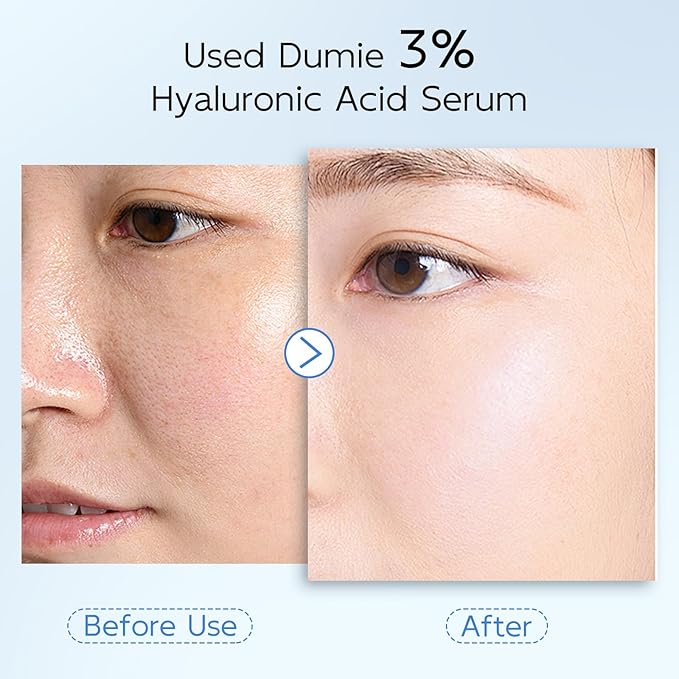 3% Hyaluronic Acid Serum for Face, Anti-Aging Hydrating Serum with 20,000 ppm Ceramide NP & 10,000ppm Acetyl Hexapeptide-8, Korean Skincare ultra hydrating serum, turm Skin/Sensitive Skin(1.5 ml*30)-GlimoraGlow