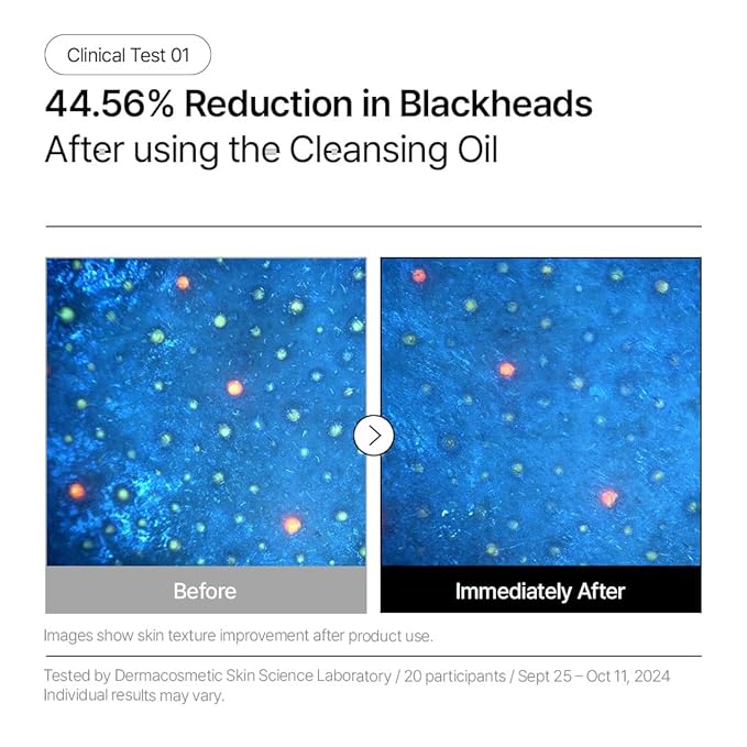 Parnell Aha Omija Ceramic Cleansing Oil 200ml / 6.76 fl.oz | blackhead melting, korean facial cleanser, korean skincare-GlimoraGlow