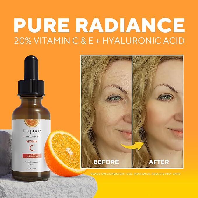 Professional Vitamin C Face Serum 20%, Anti Aging Facial Super Vit C Serum with Ascorbic Acid Hyaluronic Acid & Vitamin E for Dark Spots, Skin Care, Christmas Gift & Stocking | 1 Fl. Oz-GlimoraGlow