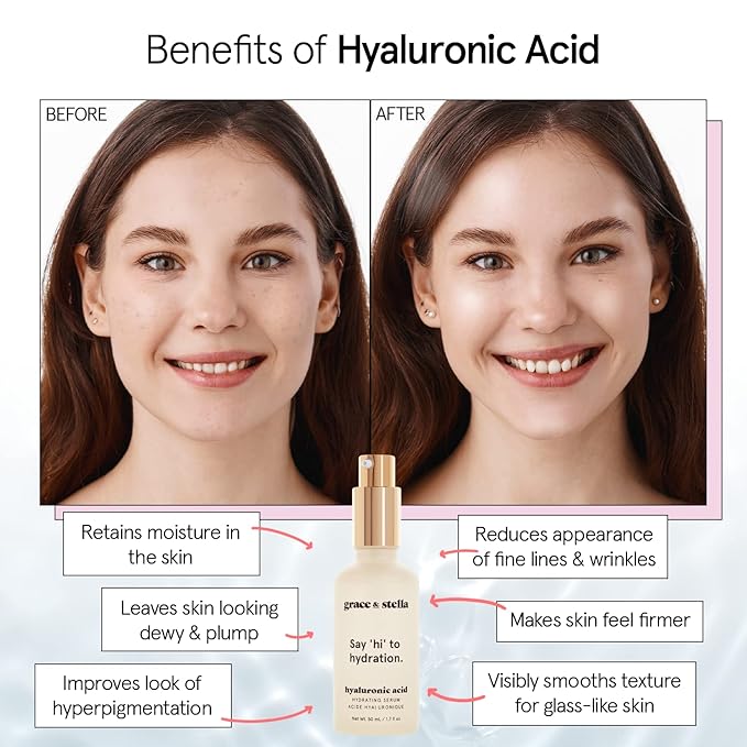 grace & stella Award Winning Hyaluronic Acid Serum (50ml/1.7 fl oz) Hydrating Hyaluronic Acid Serum for Face - Acido Hialuronico for Women - Remove Fine Lines, Wrinkles, Anti Aging - Vegan Skincare-GlimoraGlow