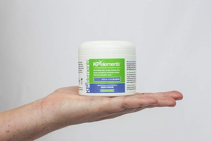 KP Elements Keratosis Pilaris Lotion (4 fl oz) - Natural Keratosis Pilaris Treatment, Moisturizing & Exfoliating AHA Lotion for KP, Vegan, Made in USA-GlimoraGlow