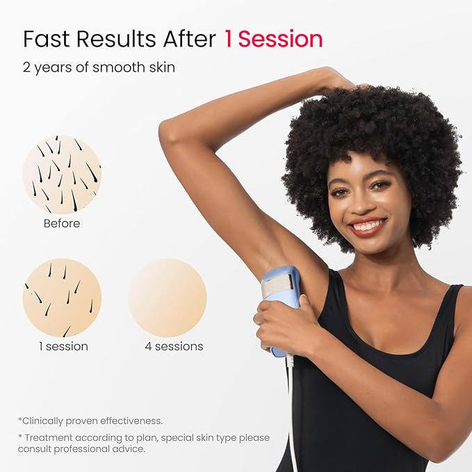 IPL Laser Hair Removal for Women and Men, 2 Lights, 2℃, 16.6 cm² Sapphire Ice Cooling for Sensitive Skin, 4-Pulse Mode for Ingrown Hair, Bikini, Face, Body Permanent Epilator Home Hair Removal Device-GlimoraGlow