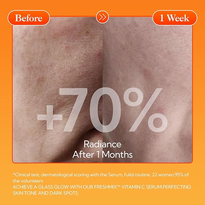 LANBENA Revolutionary Vitamin C Tablets Serum for Face, Illuminating Fcae Serum With Niacinamide, Brightening Anti-Aging Essence for Sensitive Skin, Non-Greasy, Reduces Dark Spots & Wrinkles (1.05 Oz)-GlimoraGlow