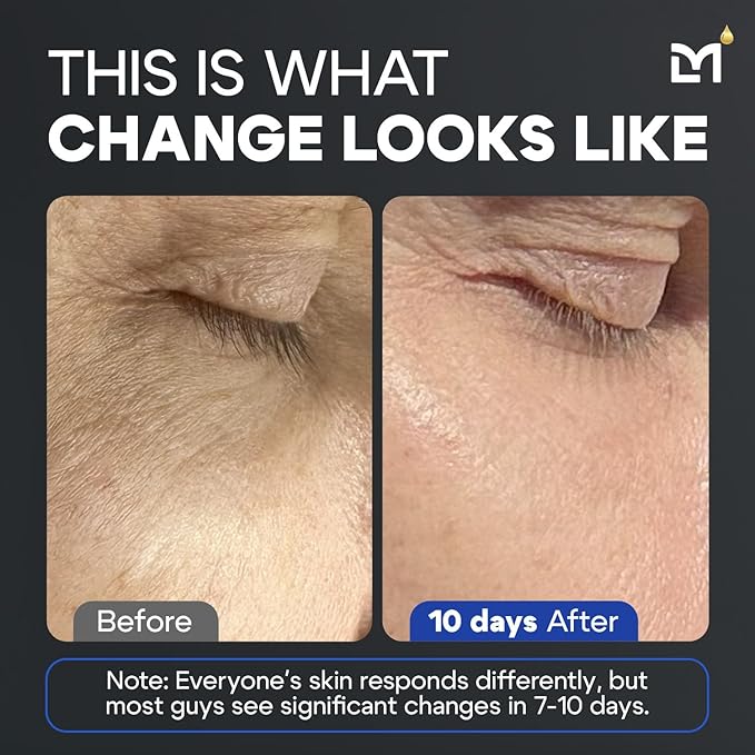 Titan Anti-Aging Peptides Serum for Face – High Potency Mens Peptide Serum Moisturizer – Mens Skin Care – Men, Dark Spots, Wrinkles, Fine Lines – Peptides, 5% Niacinamide, HA – Unscented-GlimoraGlow