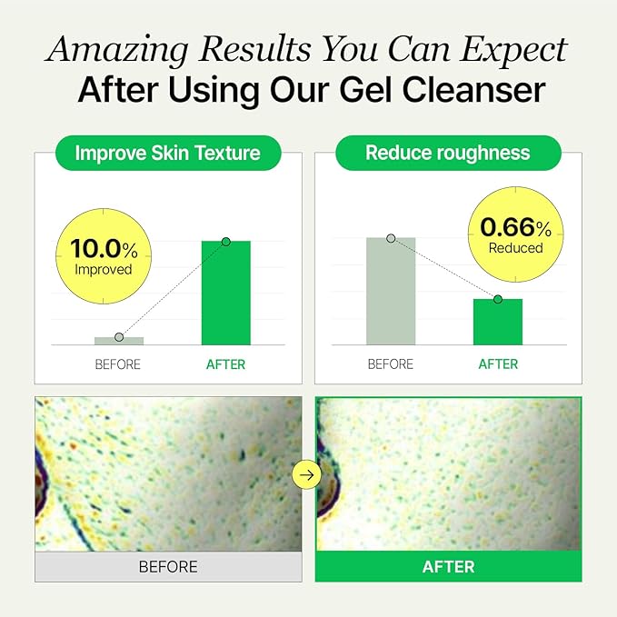 Gel Cleanser, Big Size, Gentle Exfoliation and Face cleanser for Sensitive Skin, Korean Skin Care, Vegan, 6.93 Fl Oz-GlimoraGlow