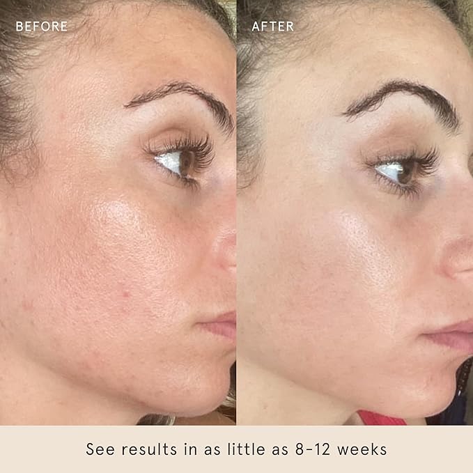 Barefaced Liquid Gold 1 Fl Oz - 15% Vitamin C Serum with Hyaluronic Acid & Vitamin E for Anti-Aging, and Hydration, Antioxidant Formula, Reduces Dark Spots, Acne & Wrinkles-GlimoraGlow