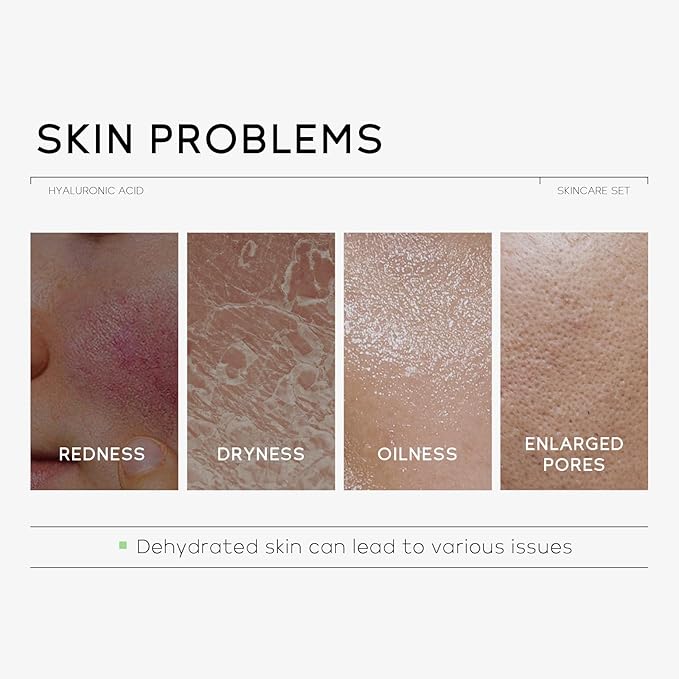 Hydrating Skin Care Set, Hyaluronic Acid Skin Care Kit with Serum for Face, Moisturizer, Travel Size Face Care Set for Women, Anti Aging Plumping Hydrating Firming for Dry Skin-GlimoraGlow