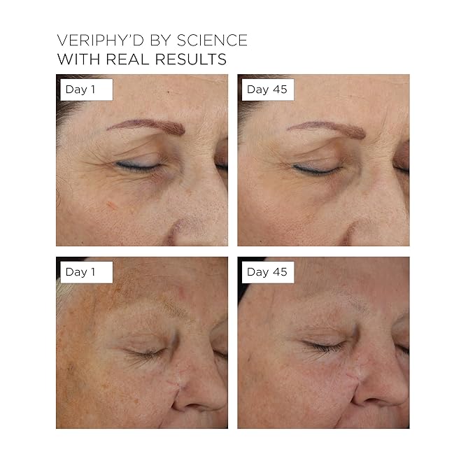 20/20 Eye Cream for Dark Circles and Puffiness | Vegan | Clean | Natural | Cruelty-free | Anti-Aging | Eye Cream for Wrinkles | Women in STEM-GlimoraGlow