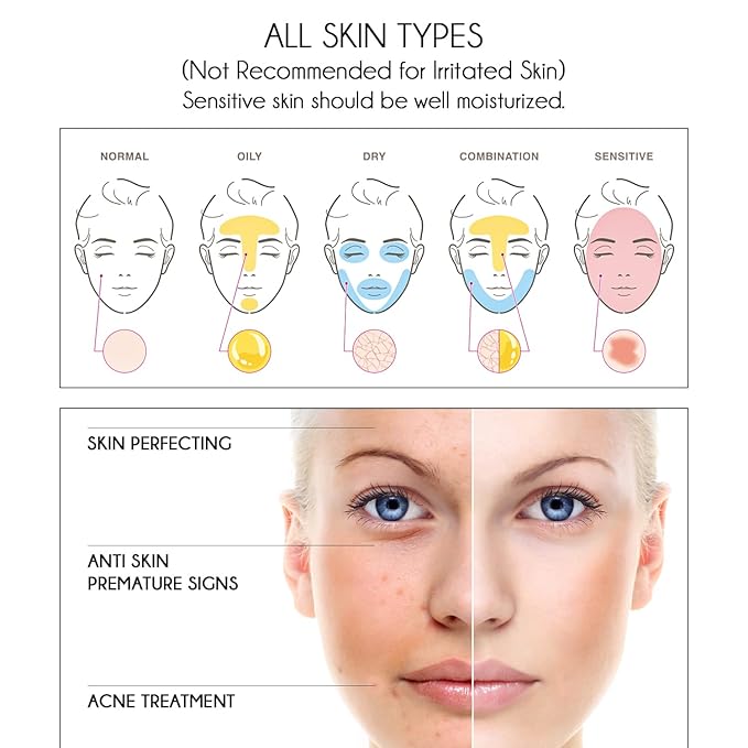 Pure Vitamin C Facial Serum with Salicylic Acid and Glycolic Acid, Anti-Wrinkle, Anti-Acne and Anti-Blackhead, Dark Spot Correcting, 7,5% AHA, Sebum Balance, ¾ oz-GlimoraGlow