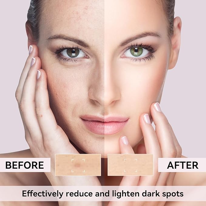 Dark Spot Remover for Face, Dark Spot Corrector for Age Spot Sun Spot Brown Spot Melasma Uneven Skin Tone, with Vitamin C and Hyaluronic Acid for Women and Men, 1.7 FL OZ-GlimoraGlow