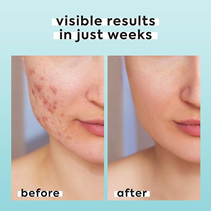 Hypochlorous Acid Spray for Face & Body - Helps Reduce Redness and Breakouts - Travel Size Hypochlorous Spray, Multi-Purpose Topical Facial Skin Repair, pH-Balancing Toner - TSA, Livaclean-GlimoraGlow