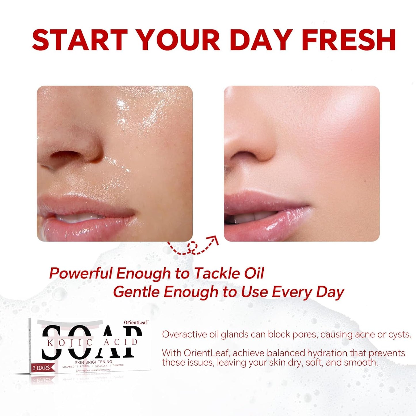 Kojic Acid Soap, Turmeric Soap Bar for Dark Spots, Fresh Citurs Scent, Gentle for Face and Body Wash with Vitamin C, Shea Butter, Retinol, Olive Oil, Collagen (3 PACK)-GlimoraGlow