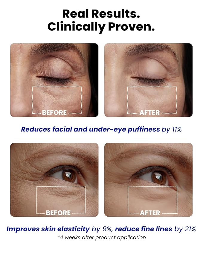 Ice Roll Serum | Cooling & Hydrating Roll-On Serum for Face, Puffy Eyes, Bakuchiol & Collagen for Firming & Lifting, Facial Roller for Depuffing, Under Eye Bag Treatment | Korean Skin Care-GlimoraGlow