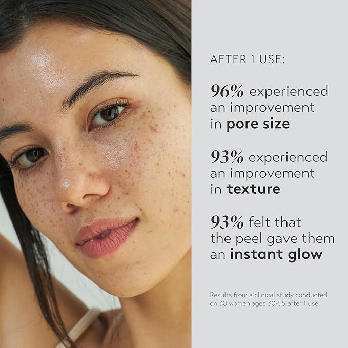 SHANI DARDEN SKIN CARE Triple Acid Peel, 2-Step Exfoliating Face Peel with Mandelic, Lactic & Glycolic Acids, Kaolin Clay Neutralizing Mask & Brush, Helps Improve Dark Spots & Skin Texture, 0.5 fl oz-GlimoraGlow