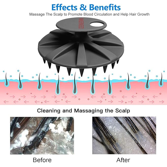 INNERNEED Scalp Massager Shampoo Brush, Wet & Dry Manual Scalp Care Head Scrubber Hair Washing, Soft Silicone Bristles, for Hair Growth, Dandruff Removal (Black+Pink)-GlimoraGlow