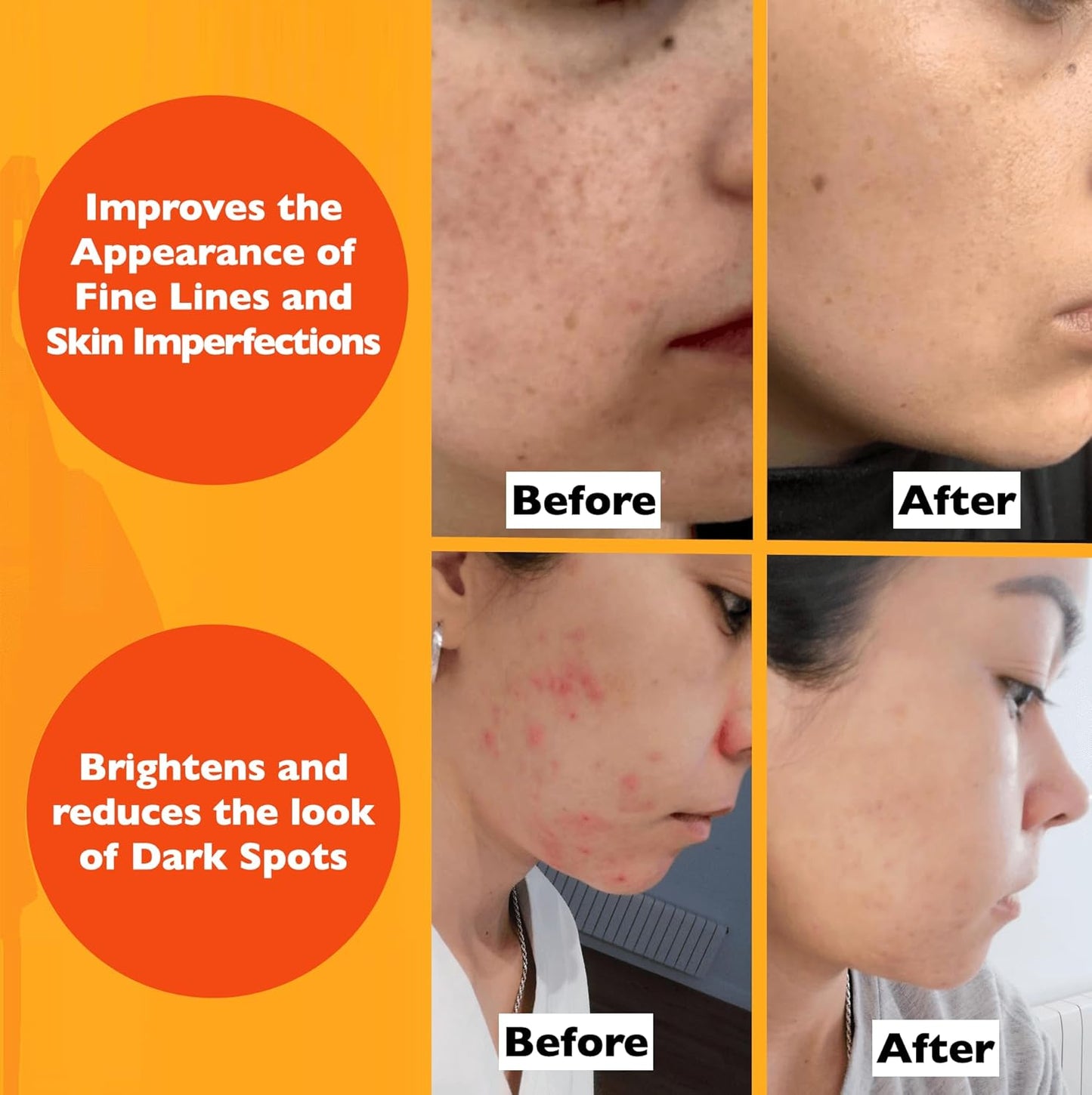 Vitamin C Serum For Face – Anti-Aging Facial Serum with Vitamin C, Hyaluronic Acid, Niacinamide, B5 & Vit E. Brightening Facial Essence for Dark Spots, Fine Lines, Wrinkles & Glowing Skin, 2 Fl Oz-GlimoraGlow