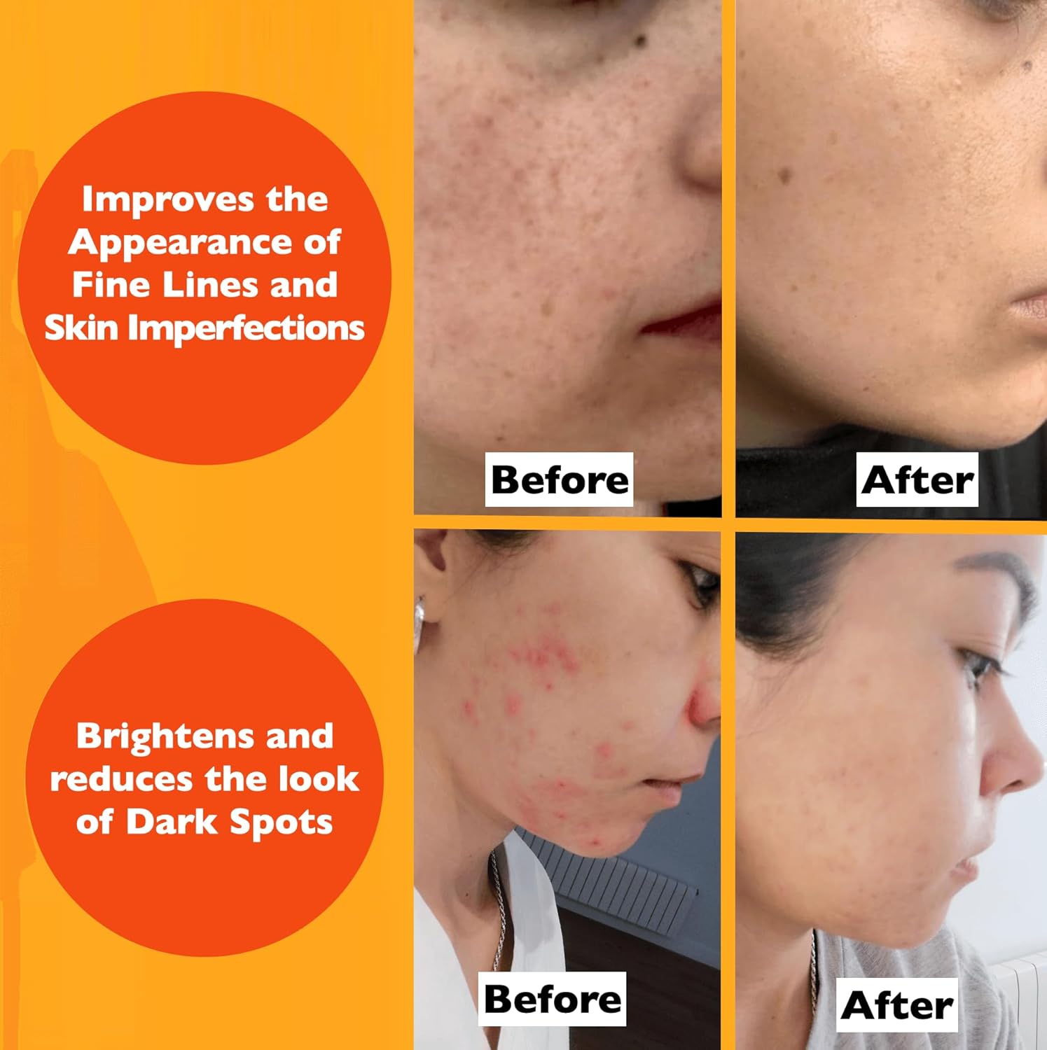 Vitamin C Serum For Face – Anti-Aging Facial Serum with Vitamin C, Hyaluronic Acid, Niacinamide, B5 & Vit E. Brightening Facial Essence for Dark Spots, Fine Lines, Wrinkles & Glowing Skin, 2 Fl Oz-GlimoraGlow