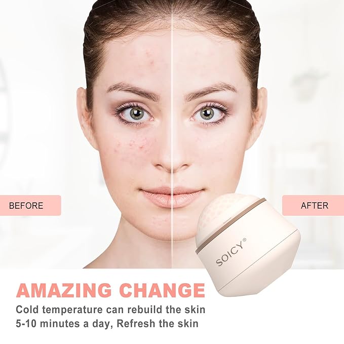 Leeshine Ice Roller Ball for Face and Eyes - Facial Skin Care Tools with a Large Roller and Carry Case Self Care Gift.Men Women (S50-Pink)-GlimoraGlow