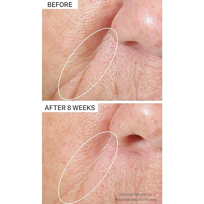 StriVectin Tighten & Lift Peptight Tightening & Brightening Face Serum with Peptides for Even Skin Tone, 1.7 Fl Oz-GlimoraGlow