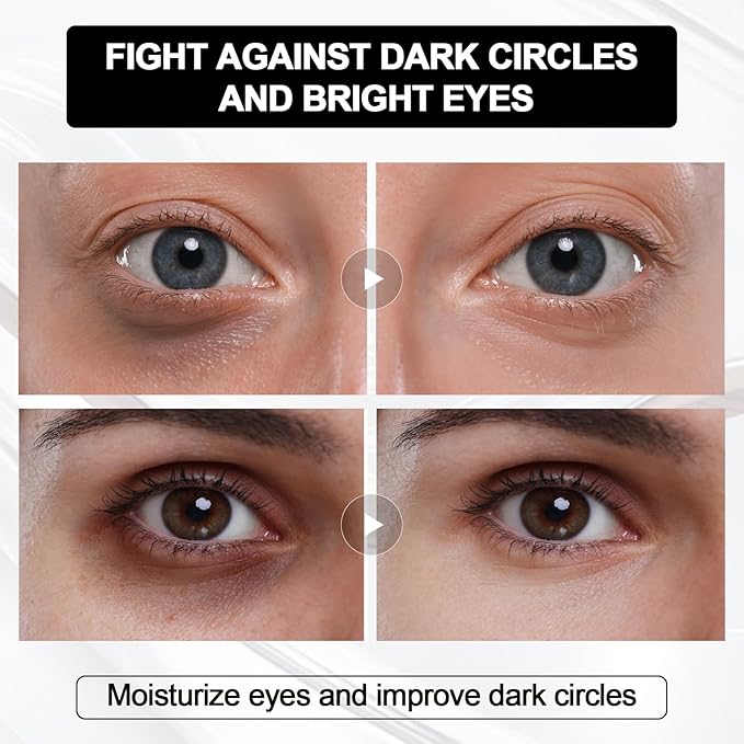 Instant Firm Eye Cream, Temporary Eye Tightener,Instant Firm Eye Tightening Cream for Firm Under Eye Firming, Reduce Fine Lines,2pcs-GlimoraGlow