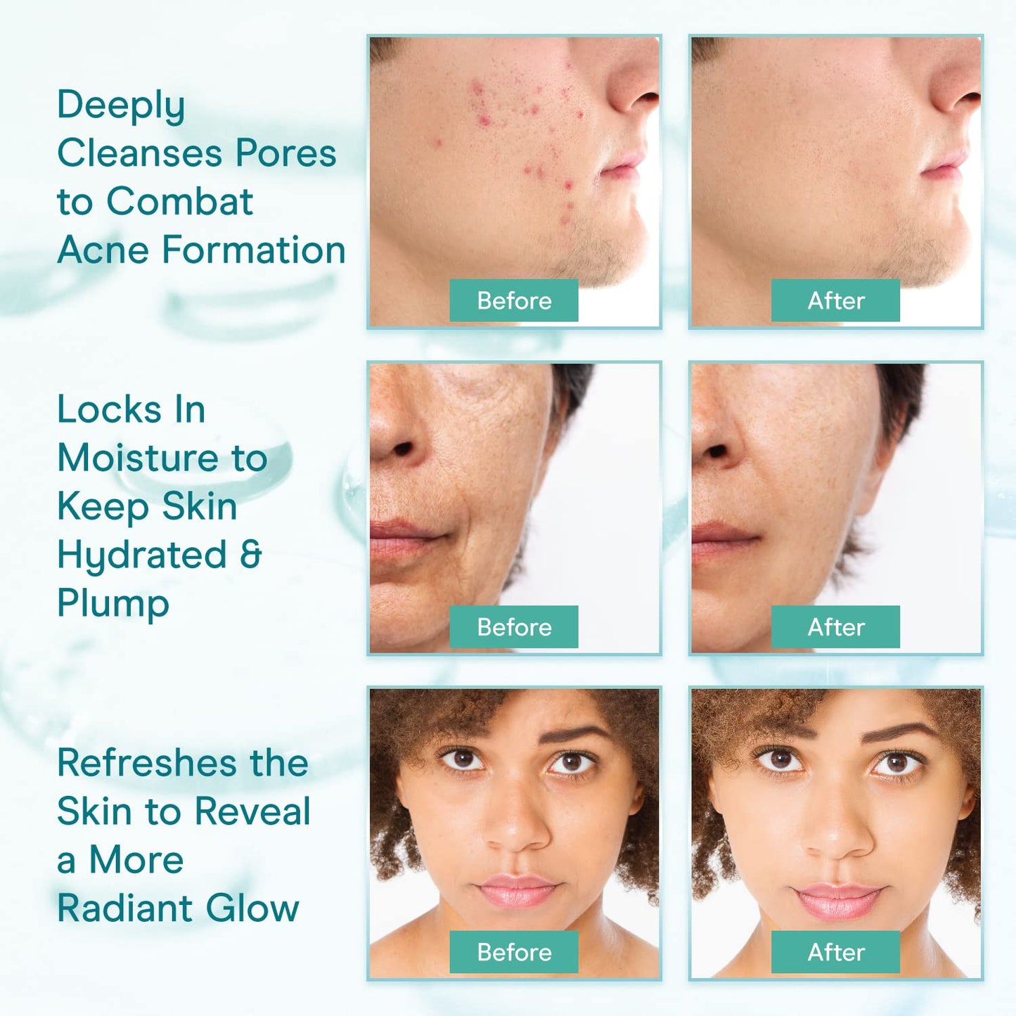 Baebody Cleansing Milk for Face - Vegan Facial Cleanser for Women and Men - Micellar Makeup Remover - Milk Cleanser Face Wash (8 fl oz)-GlimoraGlow