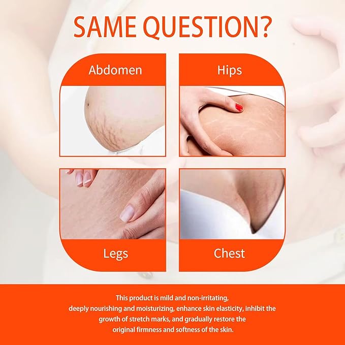 Stretch Mark Pregnancy Oil, Natural Oil Skincare Body Oil Serum for Scars and Stretch Marks, Face with Vitamin E & A for Sensitive Dry Skin and Body Moisturizer-GlimoraGlow