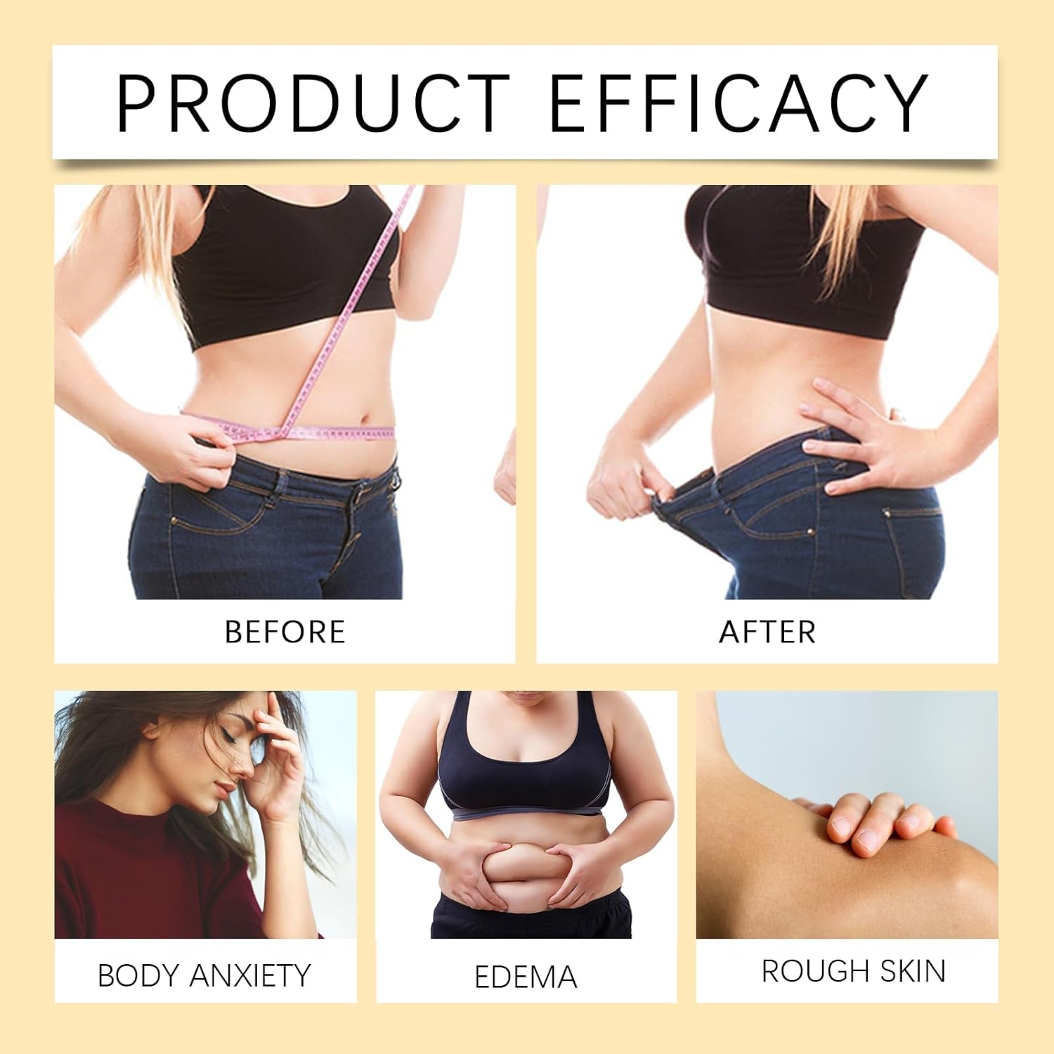 Bee Venom Comprehensive Cream,Turmeric Detox Slimming,Bee Venom Skin Treatment Cream,Body Massage Cream,Natural Skin Moisturizer for All Skin Types(2pcs)-GlimoraGlow