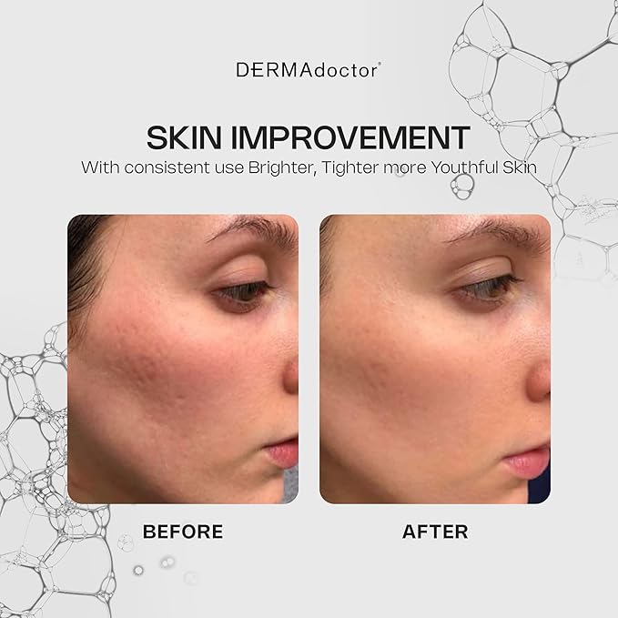 DERMAdoctor Vitamin C Face Serum 20% Vitamin C, Vitamin-E, Ferulic Acid, Ascorbic Acid Concentrated Dermatologist-Formulated Anti-Aging, Hydrating & Discoloration Correcting Serum for Face -1.0 fl oz-GlimoraGlow