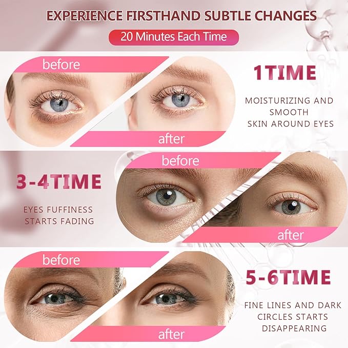 2 Packs 60 Pcs Under Eye Patches, 24K Gold+Pink, 30 Pairs Women Undereye Mask for Puffy Eyes Dark Circles Treatment, Men Collagen Gel Pads Hydrating for Eye Bags Puffiness Wrinkle, Beauty Skin Care-GlimoraGlow