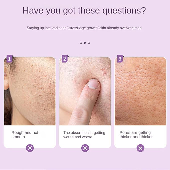 Ice Roller for Face Women - 2 in 1 Facial Ice Roller for Face & Eye Puffiness Relief, Gua Sha Facial Tools for Massage, Body Minor Cold Compress-GlimoraGlow