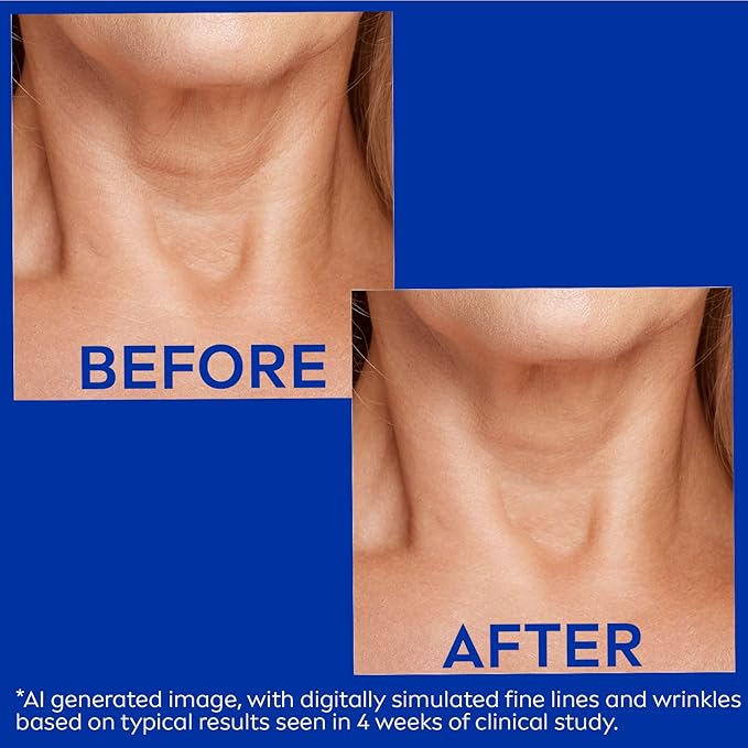 NIVEA Skin Firming & Anti Wrinkle Neck & Chest Cream with Coenzyme Q10, Creatine and Provitamin B5, Skin Firming Cream Reduces the Look of Fine Lines and Wrinkles, 6.7 Oz Tube-GlimoraGlow