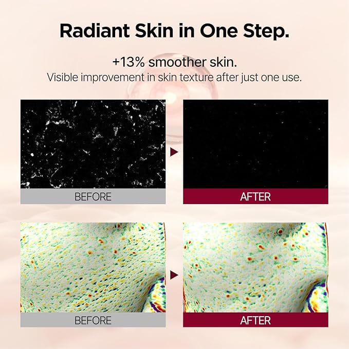 PONGDANG Nourishing Rice-Paste Wash-Off Mask | Gentle Exfoliation & Oil Control | Hydrating Care with Organic Rice Extract & Antioxidants | Helps Improve Skin Tone & Texture | Korean Skin Care-GlimoraGlow