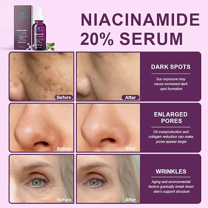 20% Niacinamide Serum for Face,Niacinamide Vitamin B3 B5 Concentrated Serum,Moisturizer,Pore Minimizer,Anti-aging Discoloration Correcting Treatment-GlimoraGlow