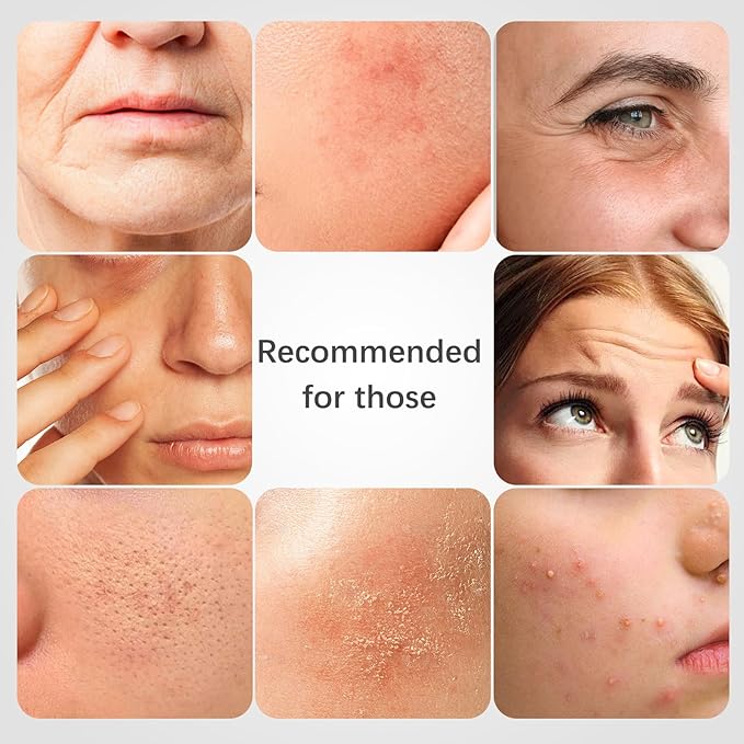 ISTON 4-in-1 Bio-Collagen Real Deep Mask Set -Plump Sagging Skin,Deep Hydration,Soothe & Repair,Nourish & Firm, Overnight Hydrogel Mask for All Skin Type-GlimoraGlow